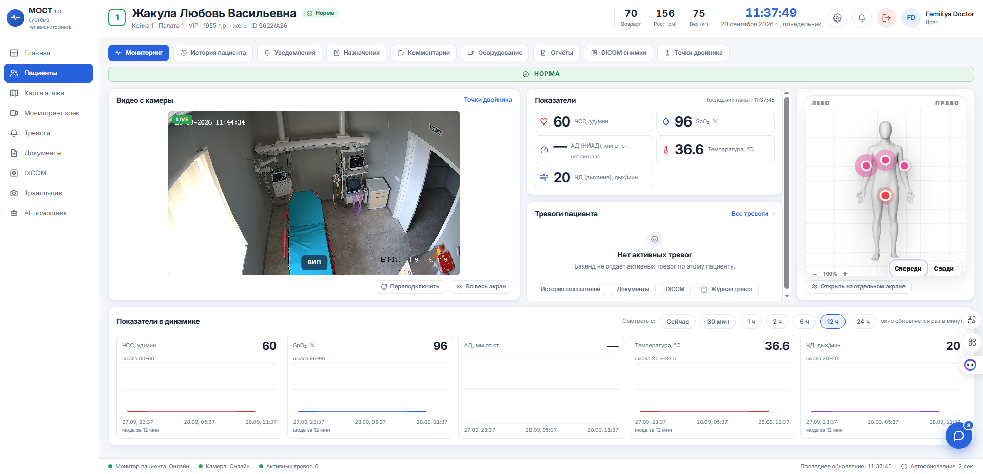 Телемониторинг